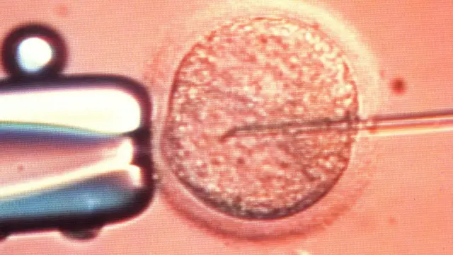 Fertilização in vitro