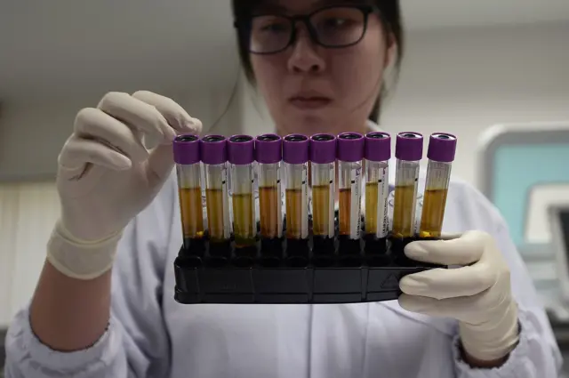 วันเอดส์โลก, โรคเอดส์, เอชไอวี, ยาต้านไวรัส, ผู้ติดเชื้อ