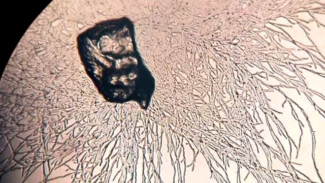 Plastic-eating fungus