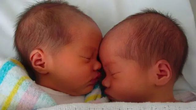 The distinction between identical and fraternal twins is not always clear. Babies Maddie and Mia were thought to be fraternal, but turned out to be identical