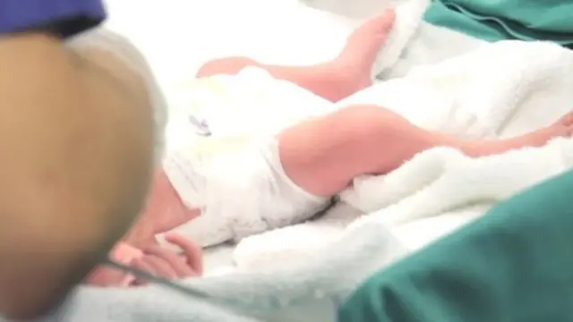 මෙම නිවුන් දරු උපත දැක්වෙන වීඩියෝ පටයක් අන්තර්ජාලයේ පළවිය