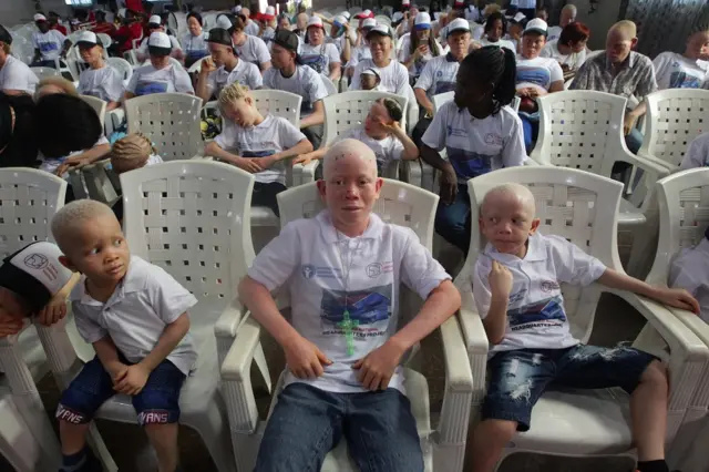Liberian Albinos attend an official program held to mark International Albino Awareness Day in Monrovia, Liberia, 13 June 2022. According to reports, the Liberia Albino Society petitioned members of the National Legislature to enact a law that would end discrimination and provide empowerment for its members. International Albinism Awareness Day is observed annually on 13 June to celebrate the human rights of persons with albinism, and to battle discrimination against those diagnosed with albinism worldwide. The United Nations" General Assembly adopted a resolution, establishing 13 June as International Albinism Awareness Day, which confirmed global focus on albinism advocacy, and encourages everyone to celebrate and promote albinism awareness globally. Albinism is a rare, non-contagious condition; both parents must carry the gene in order for it to be passed on, regardless if they themselves do not have albinism.
