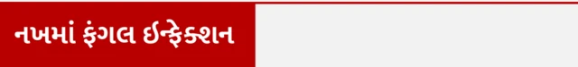 નખથી કોઈ બીમારી થાય, નખ વધારવા જોઈએ, નખ અને આરોગ્ય, બીબીસી ગુજરાતી ઍક્સ્પ્લેઇનર, બીબીસી ગુજરાતી સાથે સમજો, બીબીસી ગુજરાતી ન્યૂઝ, ગુજરાતના સમાચાર, ગુજરાત હવામાન, દેશ વિદેશના તાજા સમાચાર,