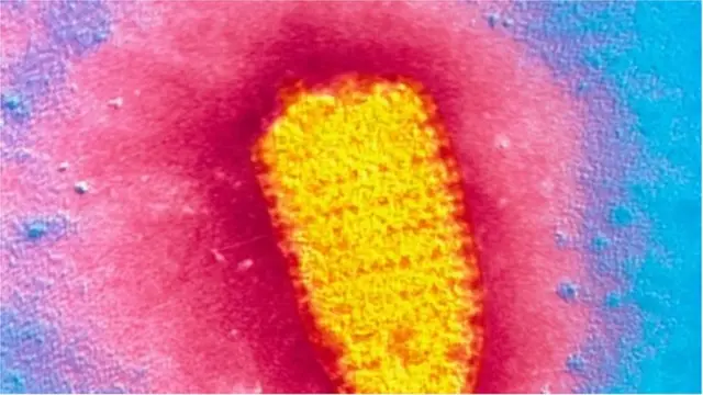 రేబిస్ వైరస్