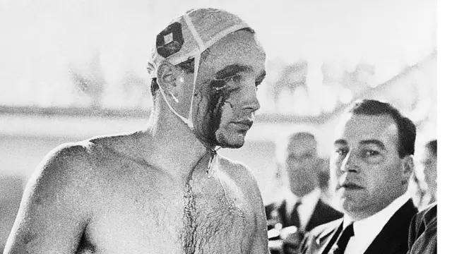 Blood streams from the cut eye of Ervin Zador- injured during a brawl with Russian water polo players