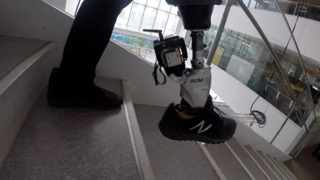 Ryan Cannon's bionic foot