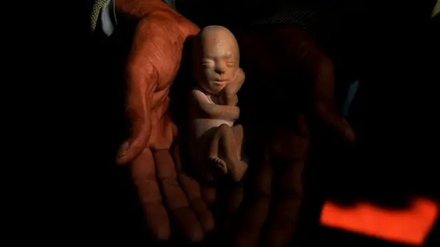 अबॉर्शन