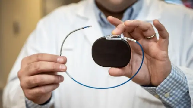 पेसमेकर 