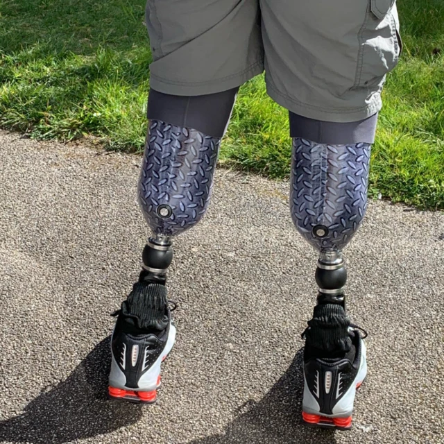 Снимак Нил Хоперових протетских ногу снимљен отпозади. Носи црно-беле патике.