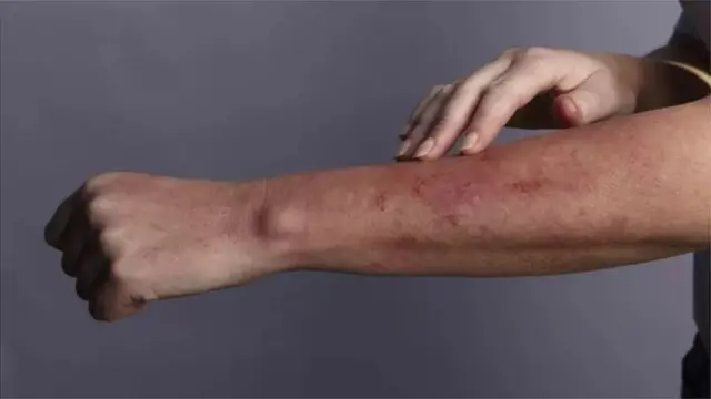 કોરોના લક્ષણો