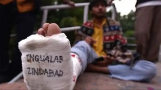 ઇજાગ્રસ્ત વિદ્યાર્થી