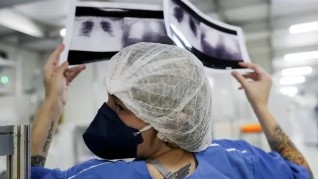 Médico olha raio-xpalpites gremio x sampaio corrêahospitalpalpites gremio x sampaio corrêaGuarulhos