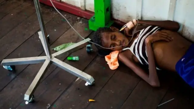 Anak di Agats, Papua, yang mengalami kelaparan.