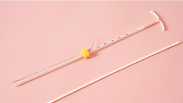 Внутрішньоматкові контрацептиви