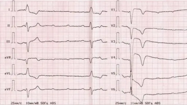 सुषमा स्वराज