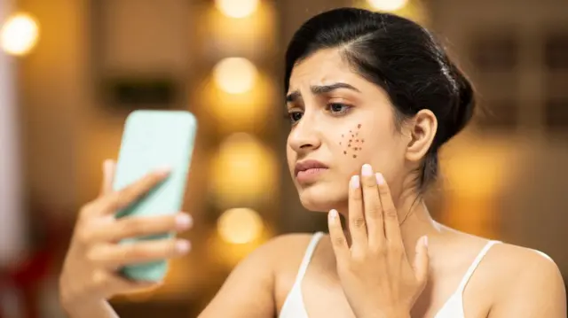 یوه ښځه چې پر مخ یې دانې راختلې دي، په موبل کې ځان ته ګوري او اندېښمنه برېښي.