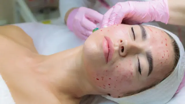 डर्मटॉलजिस्ट डॉ. दिनेश कुमार कहते हैं कि पीरियड ब्लड को चेहरे पर लगाने का कोई फ़ायदा नहीं है