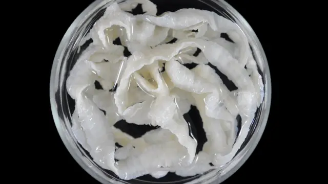 Taenia solium