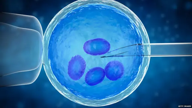 ਆਈਵੀਐਫ਼