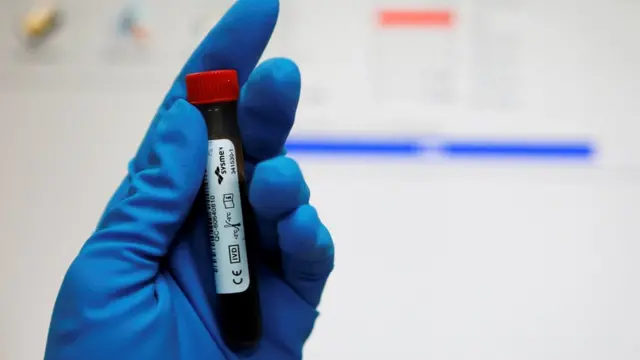 หลอดบรรจุตัวอย่างเลือด