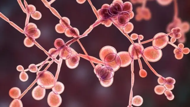 கேன்டிடியாசிஸ், பிறப்புறுப்பு அரிப்பு, மருத்துவம், நோய்த்தொற்று