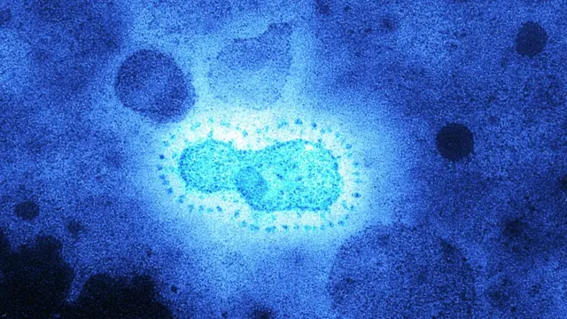 করোনাভাইরাস