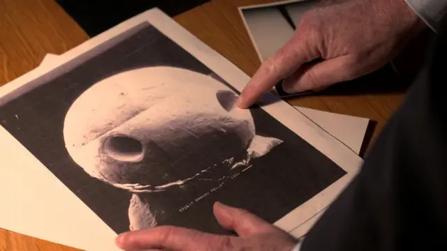 Riley mostra objeto metálico encontrado em tecido de corpo de Georgi Markov