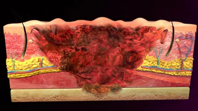 ስእሊ ቆርበት