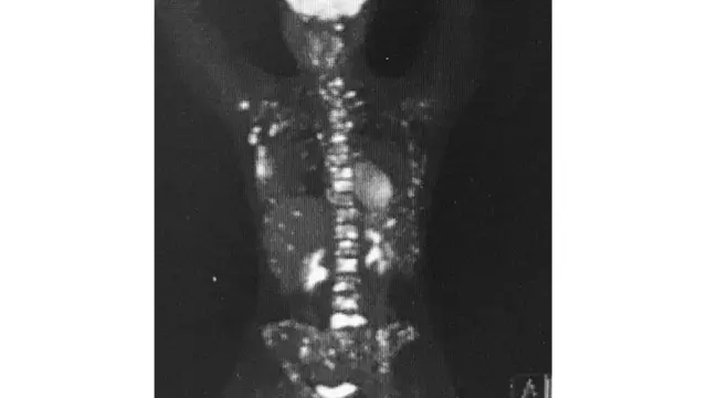 Ibipimo vyo mu cuma birerekana umubiri wa Nicky