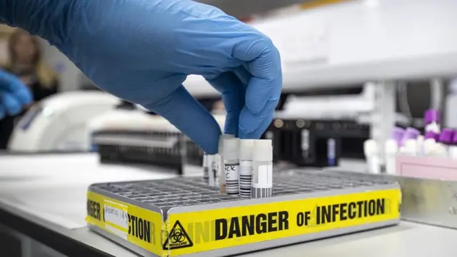 கொரோனா மருந்திற்கான ஆய்வு: உலகுக்கே முன்னோடியாக திகழ்கிறதா இந்தியா?