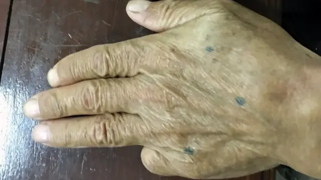 A handout photo made available by the Royal Thai Police shows retired Japanese yakuza boss and murder suspect Shigeharu Shirai showing his hands, with his left hand missing the little finger, at a police station after he was arrested in Lopburi province, Thailand, 10 January 2018.