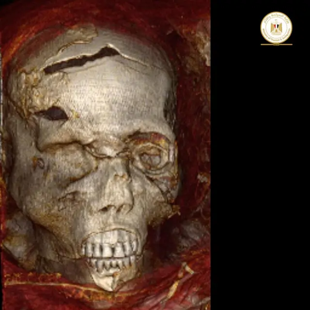 صورة لمومياء الملك سقنن رع