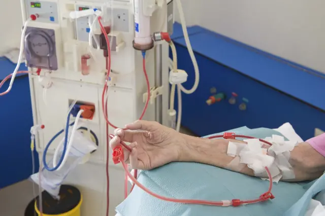 د افغانستان د عامې روغتیا وزارت چارواکي وايي په دغه مرکز کې د ډيالیز ۴۰ ماشينونه او ګڼ پرمختللي وسایل شته دي.