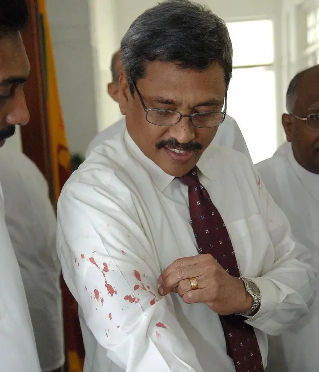 হামলার পর জামার হাতায় রক্তের দাগ দেখাচ্ছেন গোটাভায়া রাজাপাকশা
