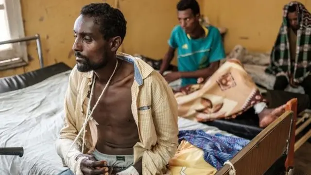 ناجين من الحرب في تيغراي