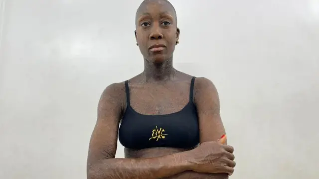 Le mannequin dit qu'elle ne s'inquiète plus de ce que les gens pensent d'elle.