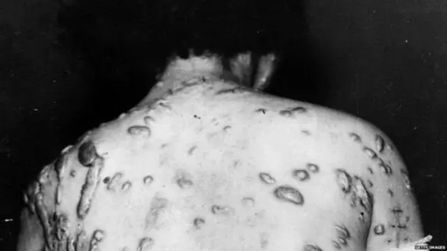 हिरोशिमा, नागासाकी, एटम बम, द्वितीय विश्व युद्ध