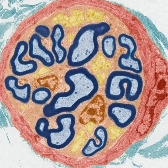 Sistema nervioso periférico