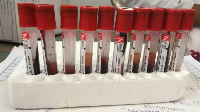 जयपुर ज़ीका