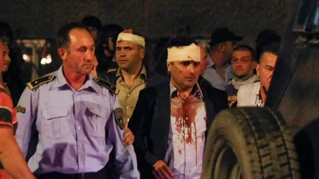 Legisladores heridos salen del Parlamento