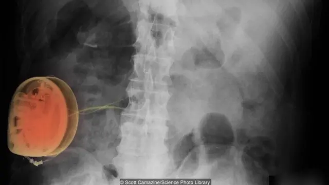 दर्द का एहसास