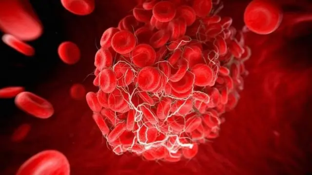 ભારત સરકારે એક નિવદેનમાં જણાવ્યું કે કોવિશિલ્ડના ફાયદાઓ તેના નુકસાન કરતા વધારે છે