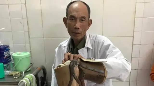 Ông Hoàng Tiến Vin, 62 tuổi là thương binh hạng 2/4.