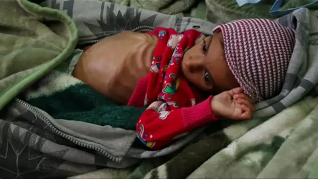 Dhaabbatni biyyoota gamtoomani Yamanitti namoonni miiliyoona 13 ta'an beelaaf saaxilamuu akeekkachiise