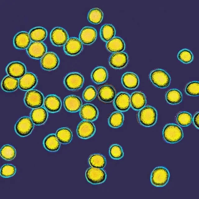 Staphylococcus aureus