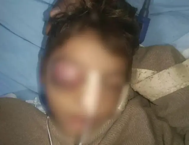 આરોપ છે કે વિદ્યાલયના સંચાલક અને શિક્ષક છૈલસિંહે 20 જુલાઈના રોજ ત્રીજા ધોરણના વિદ્યાર્થી ઇંદ્રકુમાર મેઘવાળને માર માર્યો હતો