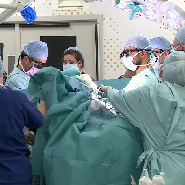 Equipe médica em sala de cirurgia em operação de Safa e Marwa em Londres