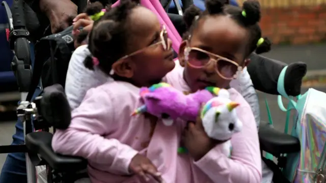 ተጣብቀው የተወለዱት መንትዮች