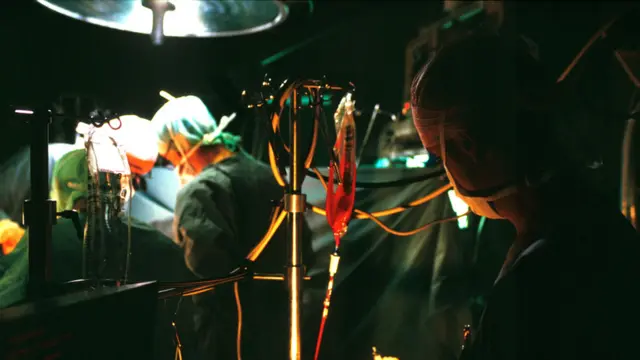 Una transfusión de sangre durante una operación.