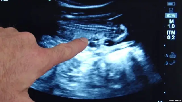 સાંકેતિક તસ્વીર